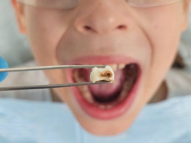 Best Emergency Dental Services Near Me  in La Cygne, KS